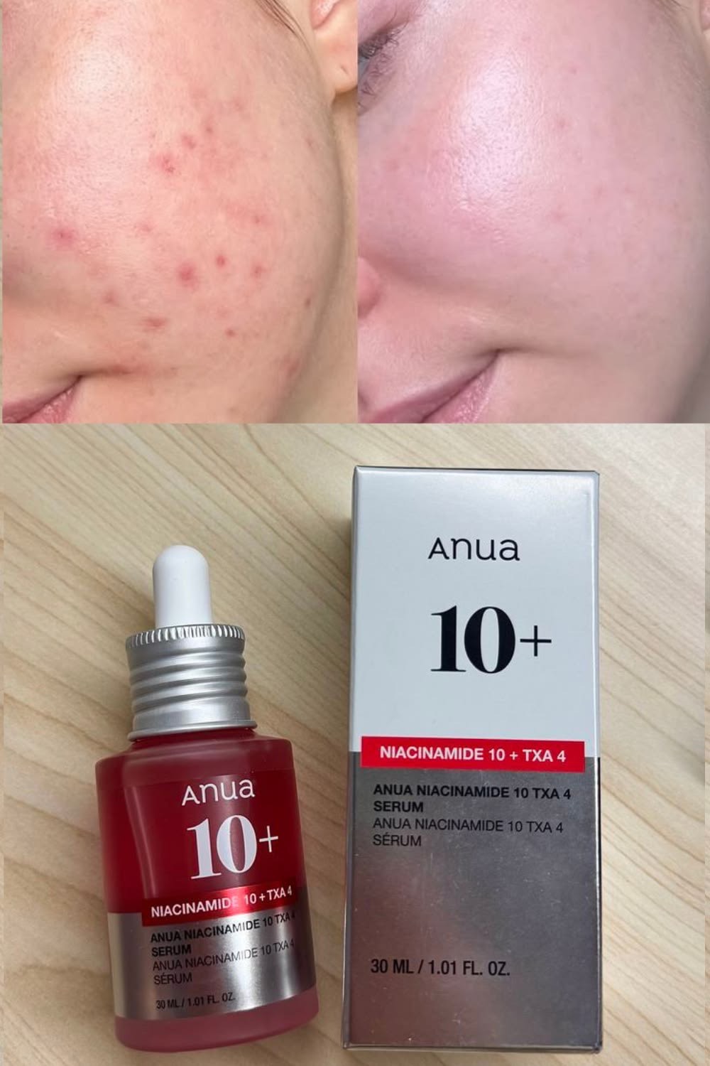 Anua